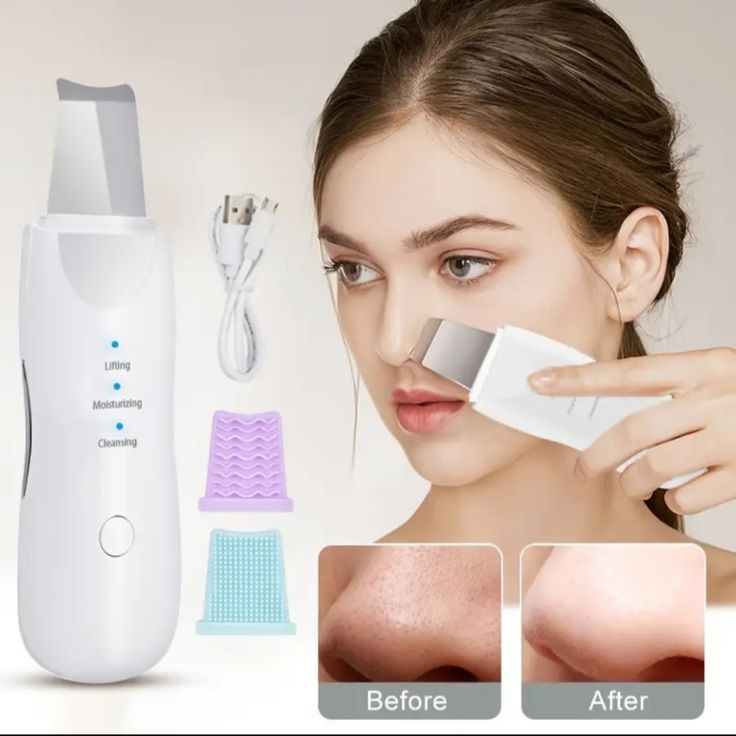 Ultrasonic Facial Skin Scrubber – Deep Pore Cleaner