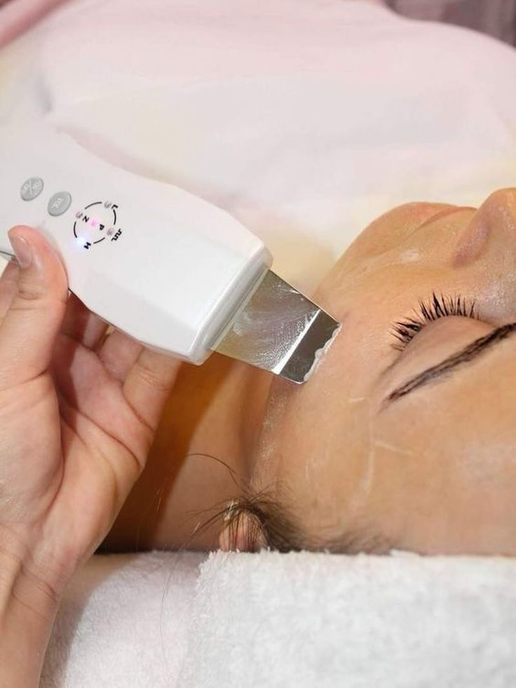 Ultrasonic Facial Skin Scrubber – Deep Pore Cleaner
